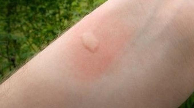 mosquitos autocaravana